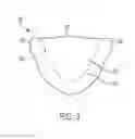 Fig. 03 - Diametric expansion features for prosthetic valves