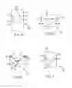 Fig. 04 - Diametric expansion features for prosthetic valves
