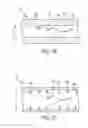 Fig. 11 - Diametric expansion features for prosthetic valves