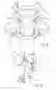 Fig. 06 - Continuous compression fixation device for the fusion of an intercalary structural augment