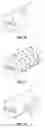 Fig. 05 - Systems and methods for orthopedic implant fixation