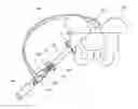 Fig. 01 - INSTRUMENT ASSEMBLY FOR USE IN HIP REPLACEMENT SURGERY