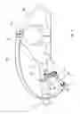Fig. 03 - INSTRUMENT ASSEMBLY FOR USE IN HIP REPLACEMENT SURGERY