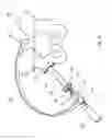 Fig. 04 - INSTRUMENT ASSEMBLY FOR USE IN HIP REPLACEMENT SURGERY