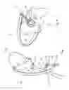Fig. 05 - INSTRUMENT ASSEMBLY FOR USE IN HIP REPLACEMENT SURGERY