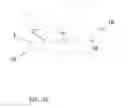 Fig. 10 - Endovascular implant and deployment devices