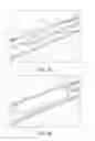 Fig. 23 - Endovascular implant and deployment devices