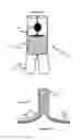 Fig. 04 - Vessel prosthesis