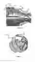 Fig. 08 - Vessel prosthesis