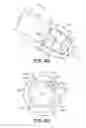 Fig. 11 - Medical device delivery system including a support member