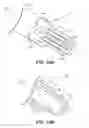 Fig. 19 - Medical device delivery system including a support member