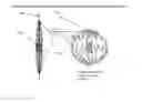 Fig. 31 - Magnetic Device For Stimulating the Vagus Nerve