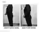 Fig. 10 - Orthotic appliance