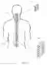 Fig. 06 - Spine support device for maintaining anatomical alignment and stability