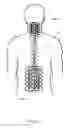Fig. 07 - Spine support device for maintaining anatomical alignment and stability