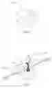 Fig. 03 - Rhinoplasty appliance and method of forming the same