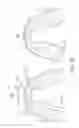 Fig. 03 - Oral appliance