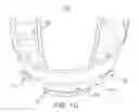 Fig. 04 - Oral appliance