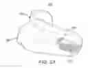 Fig. 09 - Oral appliance