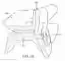 Fig. 13 - Oral appliance