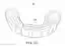 Fig. 16 - Oral appliance