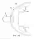 Fig. 20 - Oral appliance