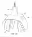 Fig. 23 - Oral appliance