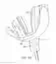 Fig. 25 - Oral appliance