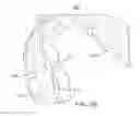 Fig. 28 - Oral appliance