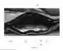 Fig. 09 - Thermal Pack