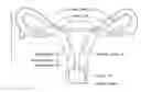 Fig. 01 - Dual balloon fluid endometrial treatment of uterine tissue