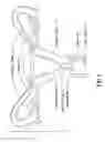 Fig. 02 - Dual balloon fluid endometrial treatment of uterine tissue