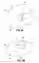 Fig. 04 - Dual balloon fluid endometrial treatment of uterine tissue