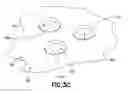 Fig. 05 - Dual balloon fluid endometrial treatment of uterine tissue