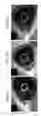Fig. 09 - THERAPEUTICS DISPENSING DEVICE AND METHODS OF MAKING SAME