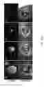 Fig. 32 - THERAPEUTICS DISPENSING DEVICE AND METHODS OF MAKING SAME