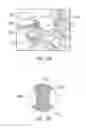 Fig. 15 - Selectively moveable valve elements for aspiration and irrigation circuits