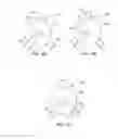Fig. 17 - Selectively moveable valve elements for aspiration and irrigation circuits