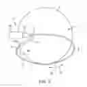 Fig. 06 - Devices and methods for cutting a lens in an eye