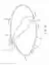 Fig. 11 - Devices and methods for cutting a lens in an eye
