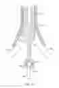 Fig. 19 - Devices and methods for cutting a lens in an eye