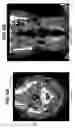 Fig. 07 - Intraoral device and method for the use thereof