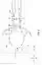 Fig. 12 - Nasogastric expandable intubation assembles