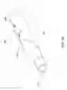 Fig. 25 - Nasogastric expandable intubation assembles