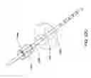 Fig. 30 - Nasogastric expandable intubation assembles