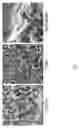 Fig. 02 - Debridement Paste