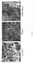 Fig. 03 - Debridement Paste