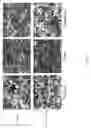 Fig. 04 - Debridement Paste