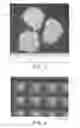 Fig. 02 - Transdermal drug administration device