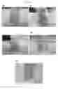 Fig. 03 - Methods and compositions for treating atopic dermatitis